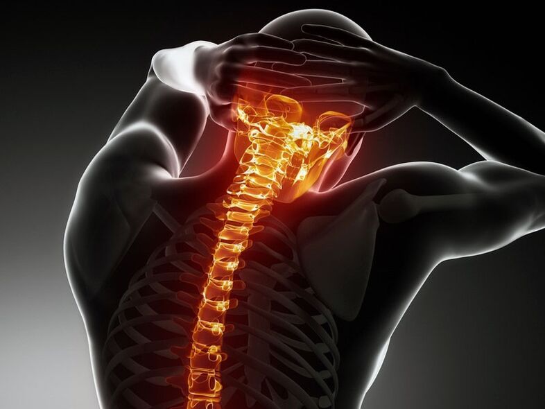Síntomas da osteocondrose