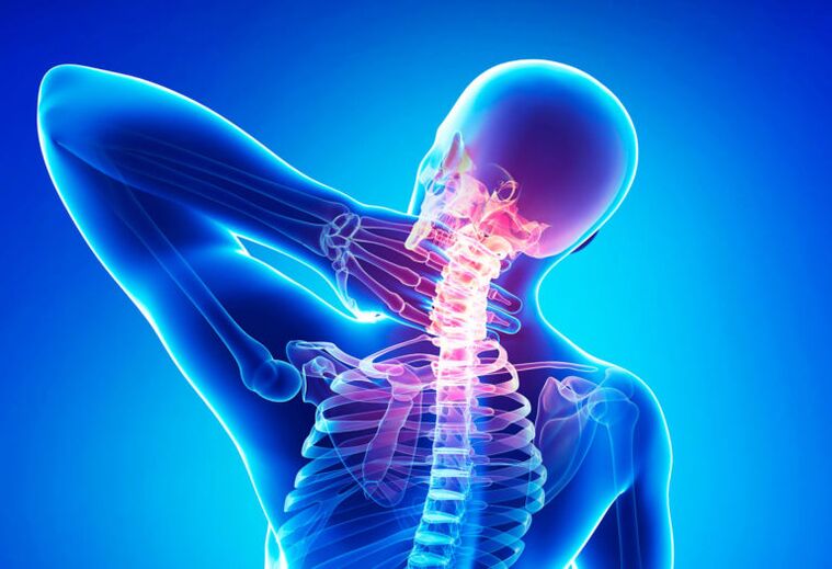 Osteocondrose da columna cervical