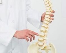 osteocondrose lumbar