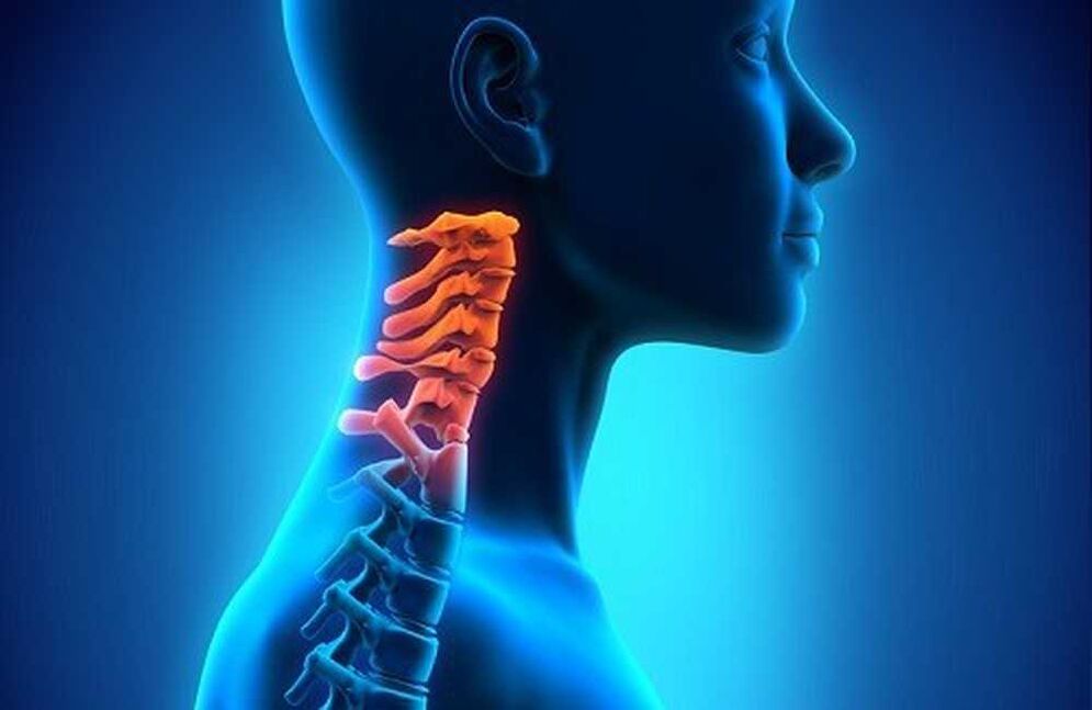 Dor na columna cervical