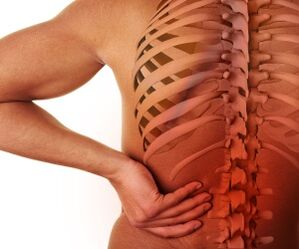 Dor de costas con osteocondrose lumbar