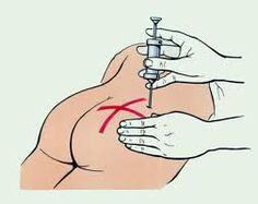 Inxección para o tratamento da osteocondrose