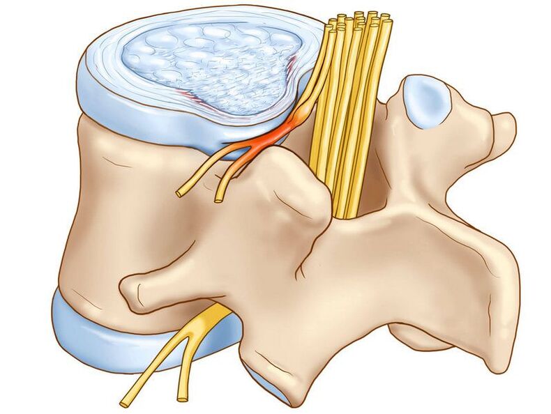 A columna vertebral é outra causa de posible dor
